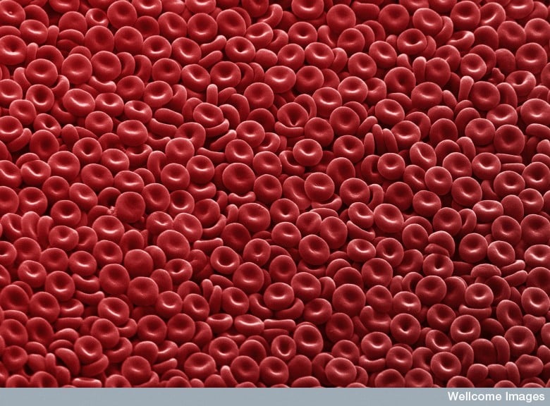 http://urbaneangel.files.wordpress.com/2009/08/red-blood-cells.jpg